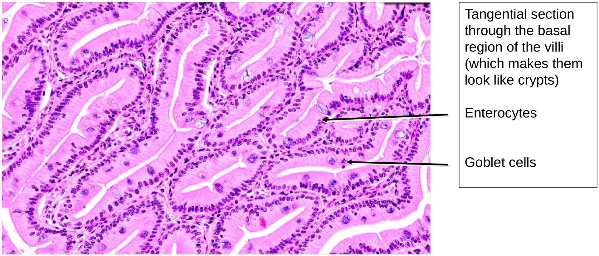 Jejunum, human 2
