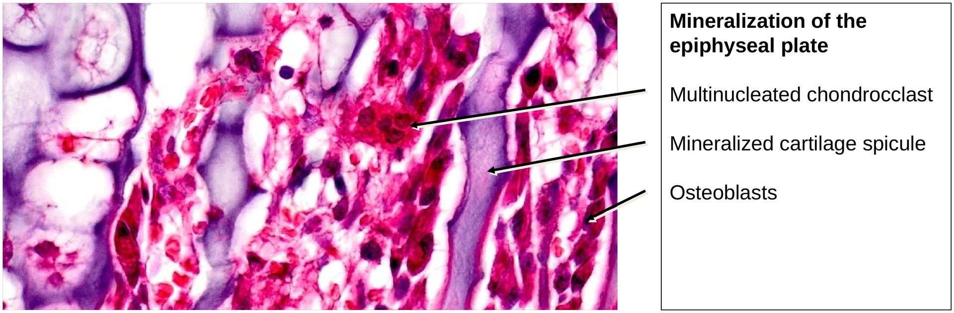 Ossification, endochondral