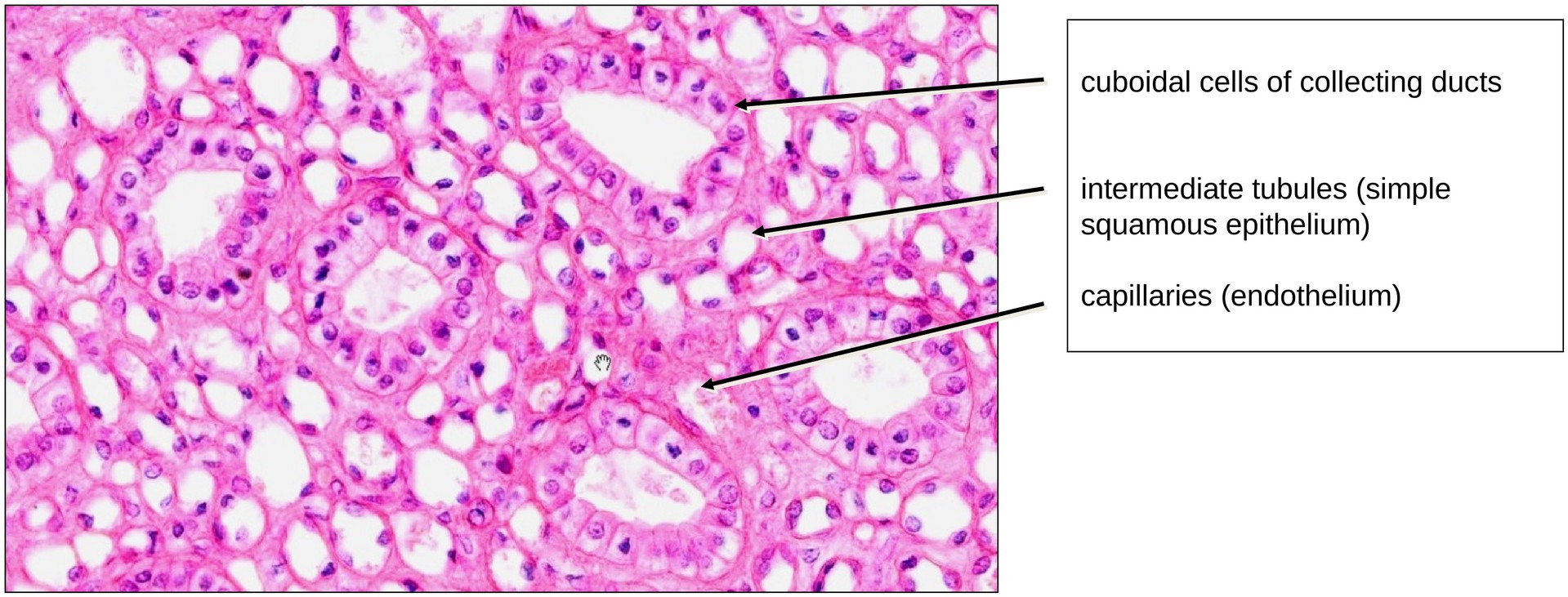 Simple squamous and cuboidal epithelium (kidney)