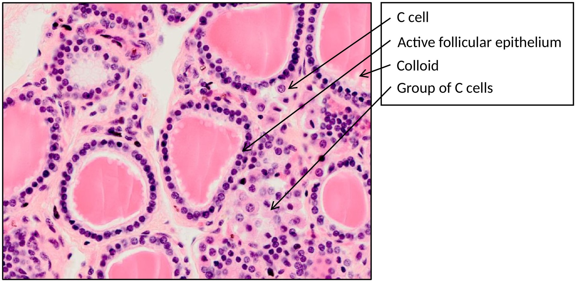 Thyroid gland
