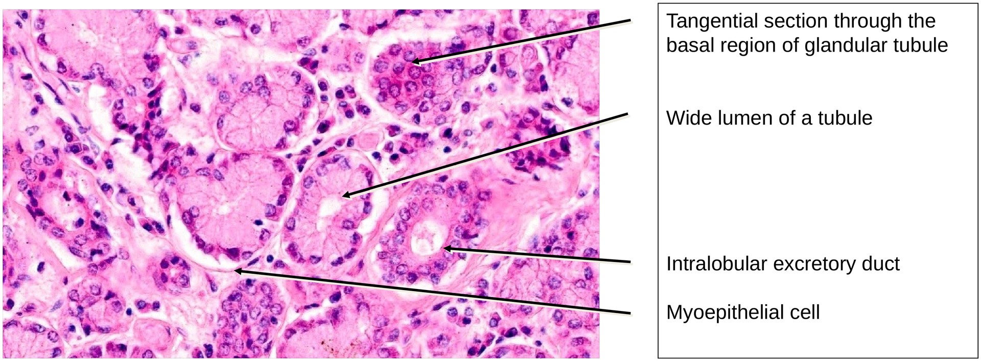 Lacrimal gland