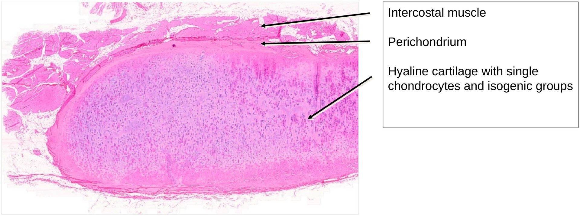 Hyaline cartilage (Rib)