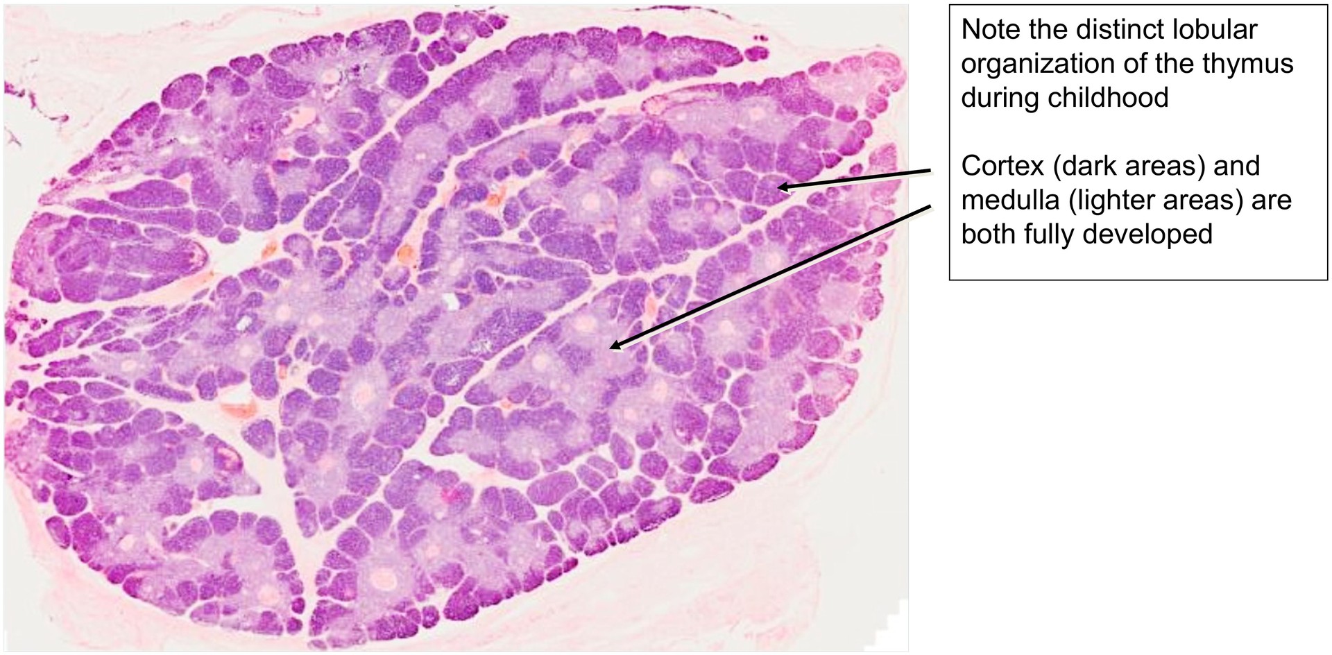 Thymus, child