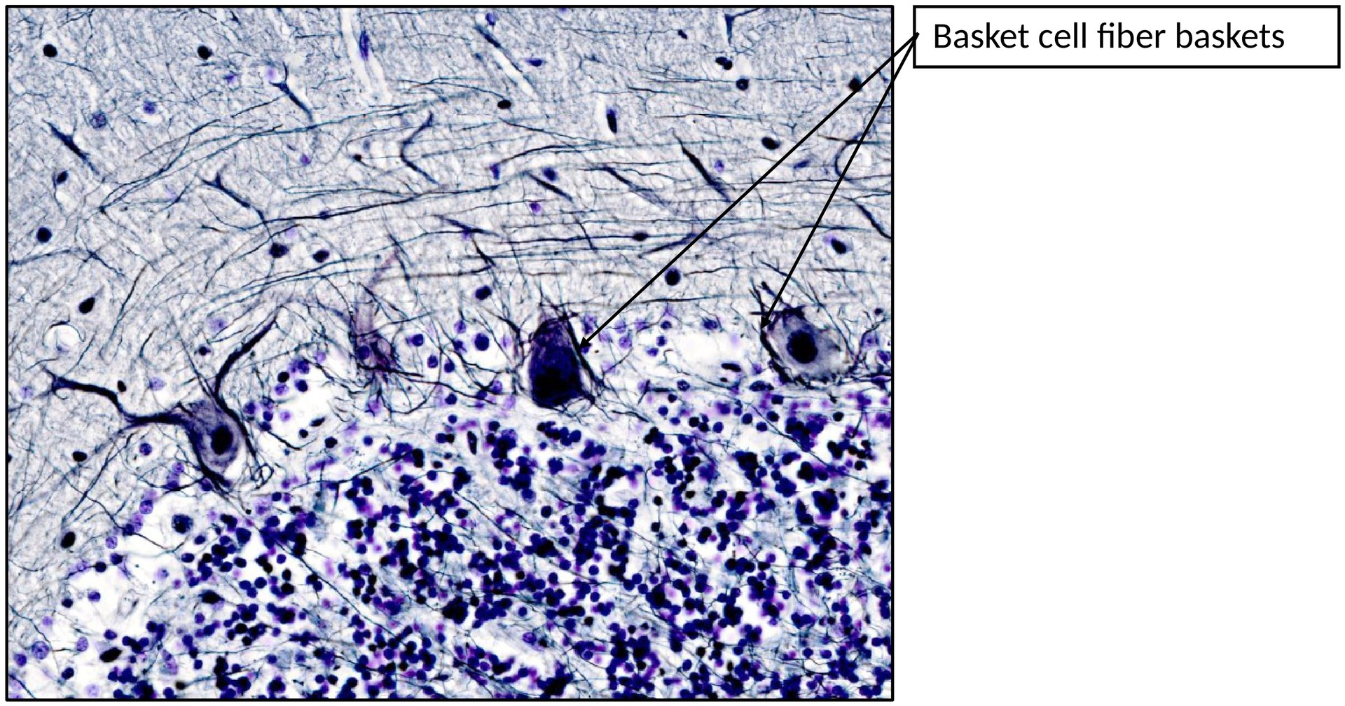 Cerebellum 2