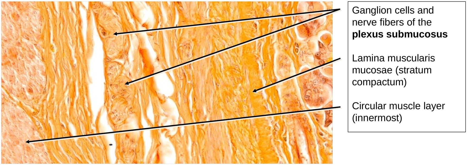 Stomach, fundus