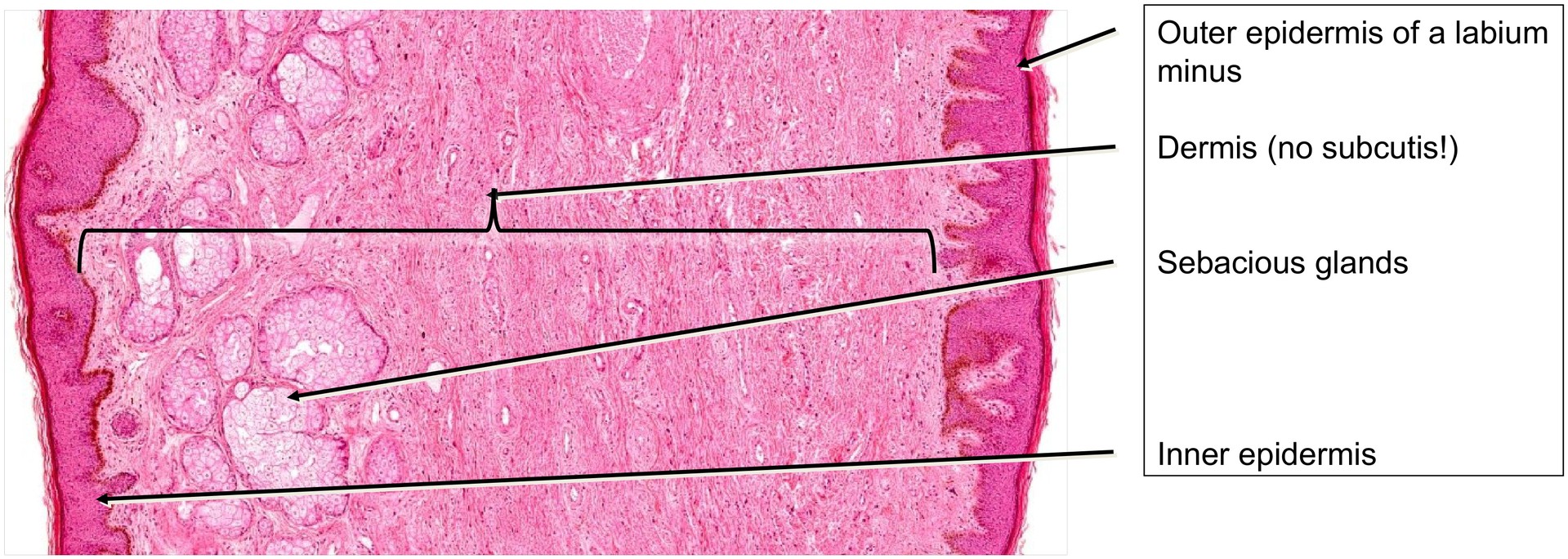 Labium minus