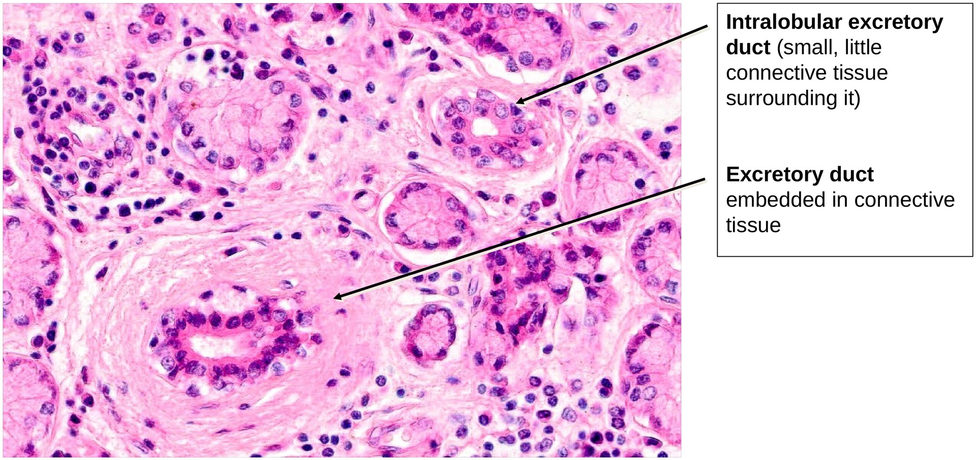 Lacrimal gland