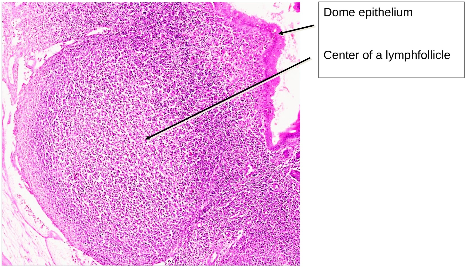 Ileum, Peyer’s patches
