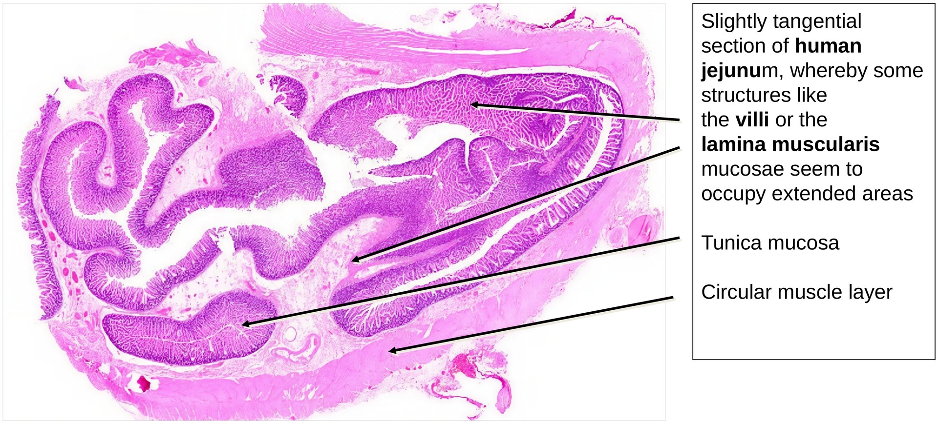 Jejunum, human 2